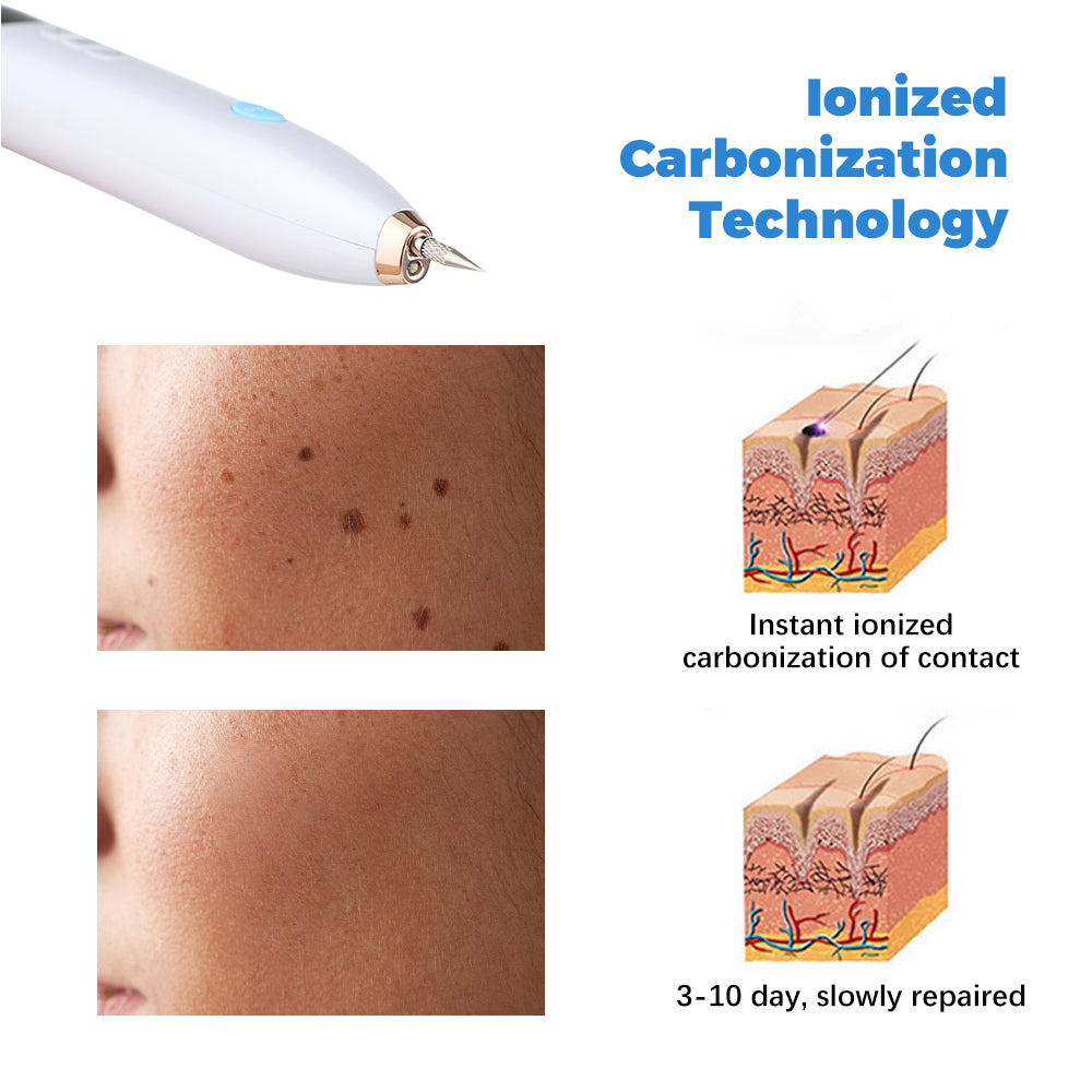 Skin Freckle remover