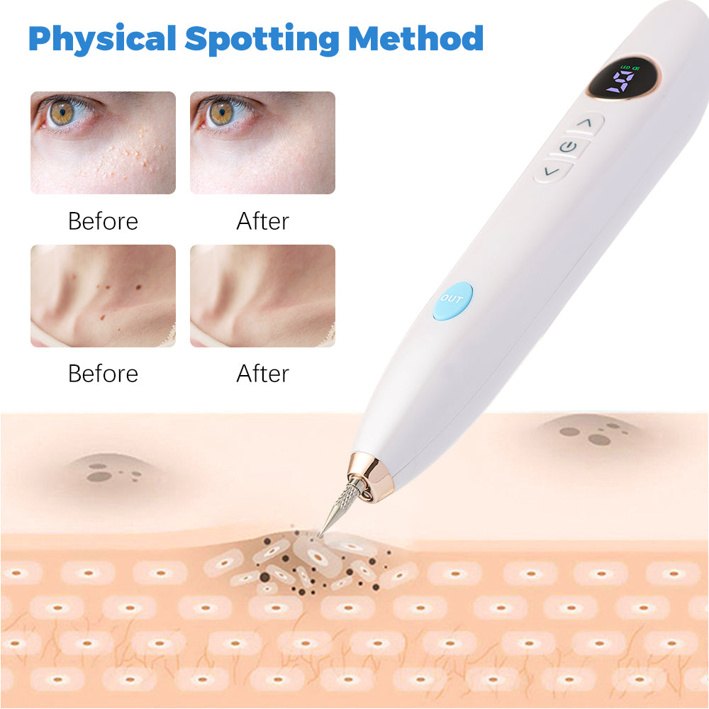 Skin Freckle remover